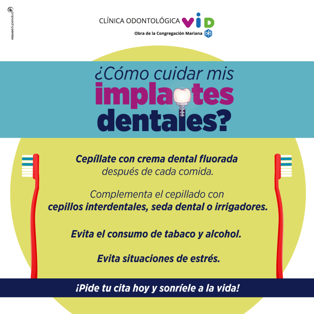 implantes dentales